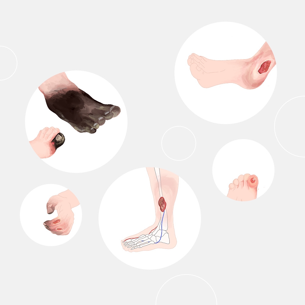 Untech - Untech - A multi-prized drug development startup | SPICE